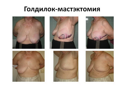 43_image