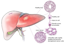 cancerdevelopment_01